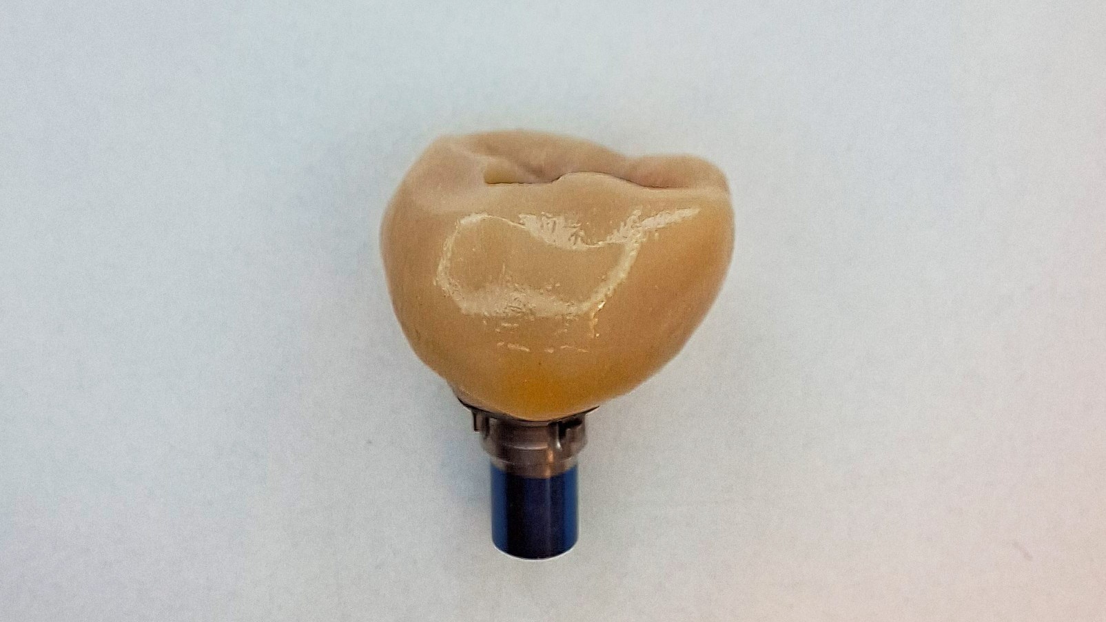 Implantat bearbeitet 2026